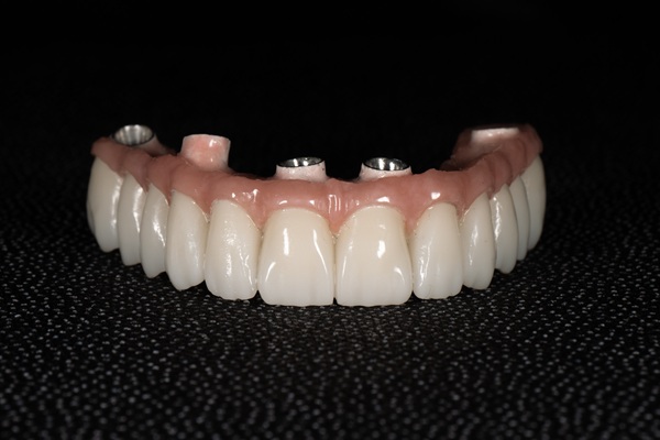 The Dangers Of Smoking With New All On   Implants